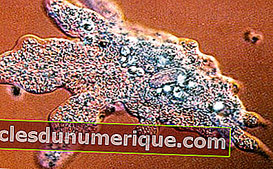 Reconocer los tipos de protistas similares a hongos